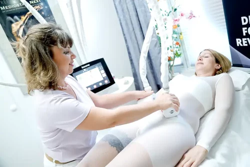 während einer Icoone-Laser-Behandlung (Bauchumfang wird mit Laser behandelt)