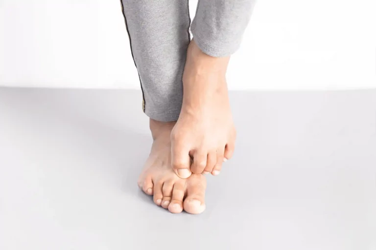 Füße die eine Nagelpilzbehandlung benötigen